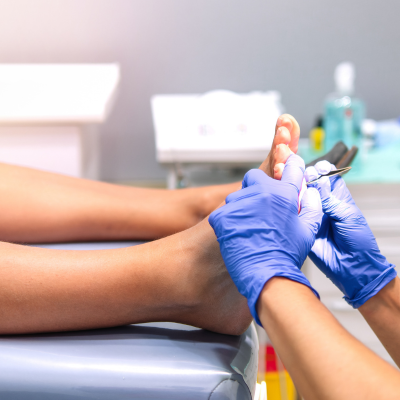 PODOLOGIA ONCOLÒGICA